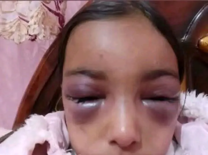 تعذيب علي يد مرات الاب.